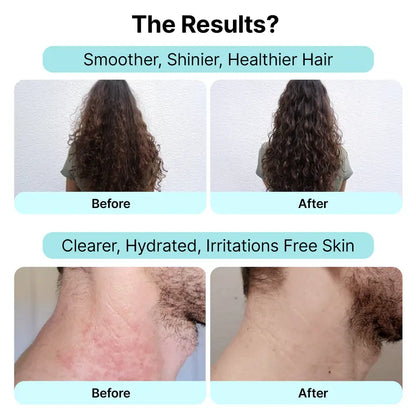 Arius Shower Water Softener & Filter System – Healthier Hair & Glowing Skin