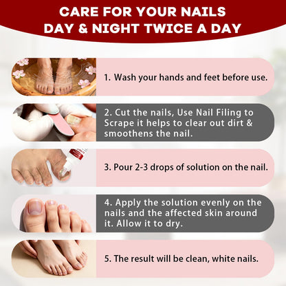 SOVS Fungi Nail Toenail Treatment Liquid – Gentle Formula for Beautiful Nails (2Pcs, 1oz)