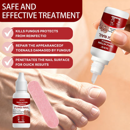SOVS Fungi Nail Toenail Treatment Liquid – Gentle Formula for Beautiful Nails (2Pcs, 1oz)