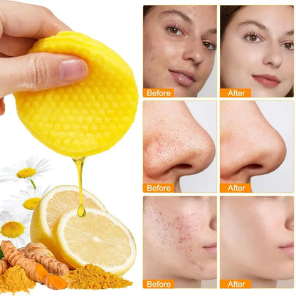 Turmeric & Kojic Acid Deep Cleansing Pads